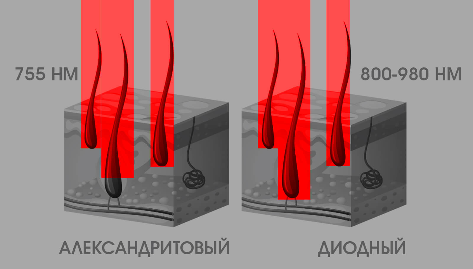 Чем отличается александритовый лазер от диодного. Разница диодного и александритового лазера. Диодный или александритовый лазер. Лазер александрит диод. Диодный лазер и александритовый лазер.