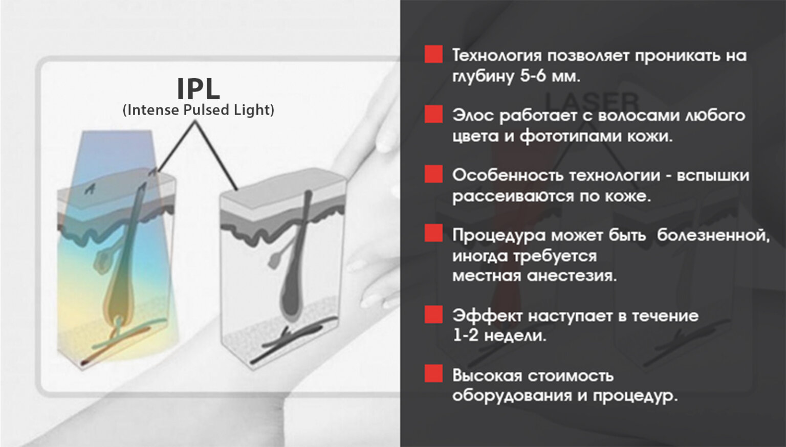 Эпиляция по технологии электронно-оптической синергии что это